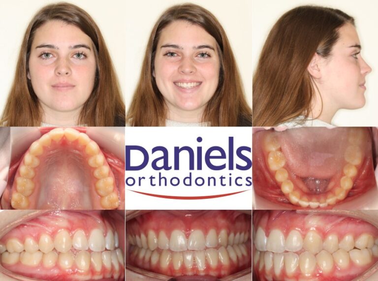 before pictures of patient's teeth